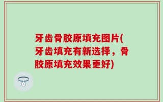 牙齿骨胶原填充图片(牙齿填充有新选择，骨胶原填充效果更好)