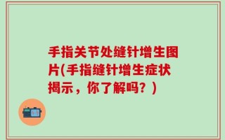 手指关节处缝针增生图片(手指缝针增生症状揭示，你了解吗？)