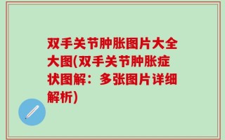 双手关节肿胀图片大全大图(双手关节肿胀症状图解：多张图片详细解析)