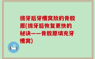 拔牙后牙槽窝放的骨胶原(拔牙后恢复更快的秘诀——骨胶原填充牙槽窝)
