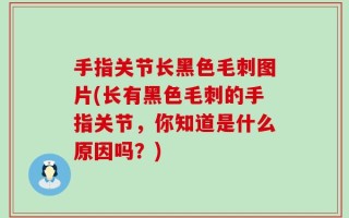 手指关节长黑色毛刺图片(长有黑色毛刺的手指关节，你知道是什么原因吗？)