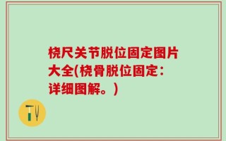 桡尺关节脱位固定图片大全(桡骨脱位固定：详细图解。)