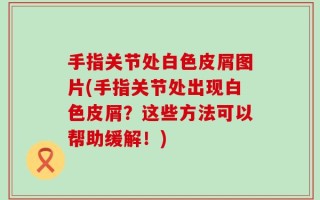 手指关节处白色皮屑图片(手指关节处出现白色皮屑？这些方法可以帮助缓解！)