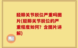 胫腓关节脱位严重吗图片(胫腓关节脱位的严重程度如何？含图片讲解)