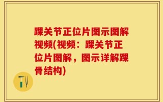 踝关节正位片图示图解视频(视频：踝关节正位片图解，图示详解踝骨结构)
