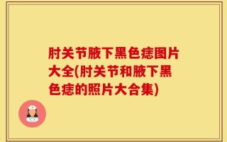 肘关节腋下黑色痣图片大全(肘关节和腋下黑色痣的照片大合集)