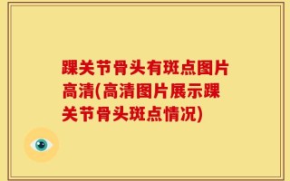 踝关节骨头有斑点图片高清(高清图片展示踝关节骨头斑点情况)