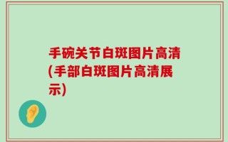 手碗关节白斑图片高清(手部白斑图片高清展示)