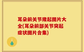 耳朵前关节隆起图片大全(耳朵前部关节突起症状图片合集)