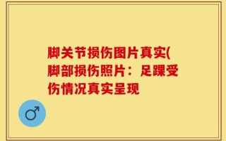 脚关节损伤图片真实(脚部损伤照片：足踝受伤情况真实呈现