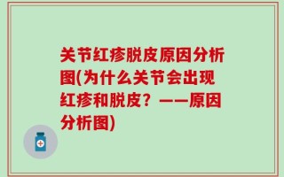 关节红疹脱皮原因分析图(为什么关节会出现红疹和脱皮？——原因分析图)