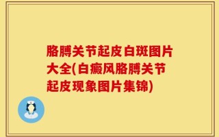 胳膊关节起皮白斑图片大全(白癜风胳膊关节起皮现象图片集锦)