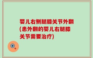 婴儿右侧腿膝关节外翻(患外翻的婴儿右腿膝关节需要治疗)