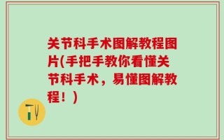 关节科手术图解教程图片(手把手教你看懂关节科手术，易懂图解教程！)