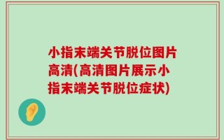 小指末端关节脱位图片高清(高清图片展示小指末端关节脱位症状)