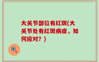大关节部位有红斑(大关节处有红斑病症，如何应对？)