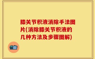 膝关节积液消除手法图片(消除膝关节积液的几种方法及步骤图解)