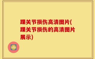 踝关节损伤高清图片(踝关节损伤的高清图片展示)