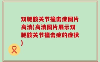 双腿髋关节撞击症图片高清(高清图片展示双腿髋关节撞击症的症状)