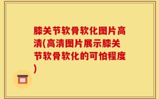膝关节软骨软化图片高清(高清图片展示膝关节软骨软化的可怕程度)