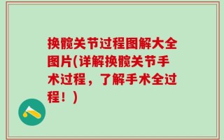 换髋关节过程图解大全图片(详解换髋关节手术过程，了解手术全过程！)