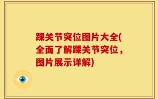 踝关节突位图片大全(全面了解踝关节突位，图片展示详解)