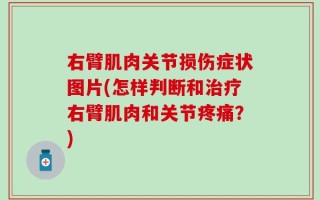 右臂肌肉关节损伤症状图片(怎样判断和治疗右臂肌肉和关节疼痛？)