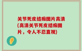 关节死皮结痂图片高清(高清关节死皮结痂图片，令人不忍直视)