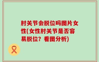 肘关节会脱位吗图片女性(女性肘关节是否容易脱位？看图分析)