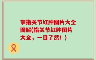 掌指关节红肿图片大全图解(指关节红肿图片大全，一目了然！)