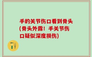 手的关节伤口看到骨头(骨头外露！手关节伤口疑似深度损伤)