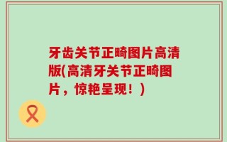 牙齿关节正畸图片高清版(高清牙关节正畸图片，惊艳呈现！)