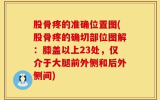 股骨疼的准确位置图(股骨疼的确切部位图解：膝盖以上23处，仅介于大腿前外侧和后外侧间)