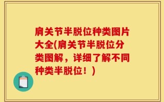 肩关节半脱位种类图片大全(肩关节半脱位分类图解，详细了解不同种类半脱位！)
