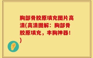 胸部骨胶原填充图片高清(高清图解：胸部骨胶原填充，丰胸神器！)