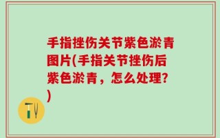 手指挫伤关节紫色淤青图片(手指关节挫伤后紫色淤青，怎么处理？)