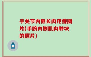 手关节内侧长肉疙瘩图片(手腕内侧肌肉肿块的照片)