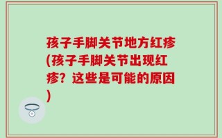 孩子手脚关节地方红疹(孩子手脚关节出现红疹？这些是可能的原因)
