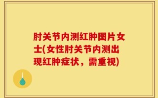 肘关节内测红肿图片女士(女性肘关节内测出现红肿症状，需重视)