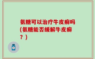 氨糖可以治疗牛皮癣吗(氨糖能否缓解牛皮癣？)