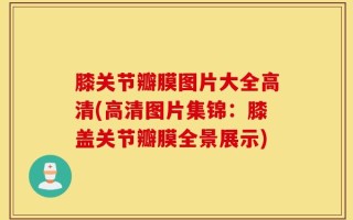 膝关节瓣膜图片大全高清(高清图片集锦：膝盖关节瓣膜全景展示)