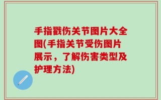 手指戳伤关节图片大全图(手指关节受伤图片展示，了解伤害类型及护理方法)
