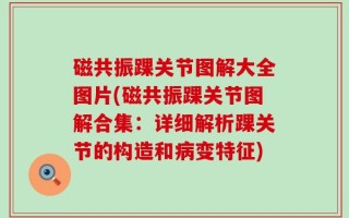 磁共振踝关节图解大全图片(磁共振踝关节图解合集：详细解析踝关节的构造和病变特征)