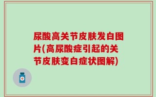 尿酸高关节皮肤发白图片(高尿酸症引起的关节皮肤变白症状图解)
