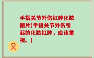 手指关节外伤红肿化脓图片(手指关节外伤引起的化脓红肿，应该重视。)