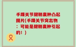 手踝关节腱鞘囊肿凸起图片(手踝关节突出物：可能是腱鞘囊肿引起的！)
