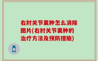 右肘关节囊肿怎么消除图片(右肘关节囊肿的治疗方法及预防措施)