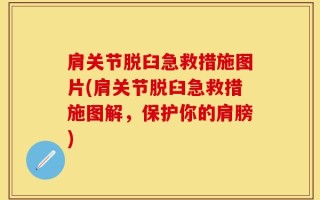 肩关节脱臼急救措施图片(肩关节脱臼急救措施图解，保护你的肩膀)