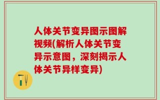 人体关节变异图示图解视频(解析人体关节变异示意图，深刻揭示人体关节异样变异)