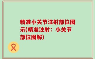 精准小关节注射部位图示(精准注射：小关节部位图解)